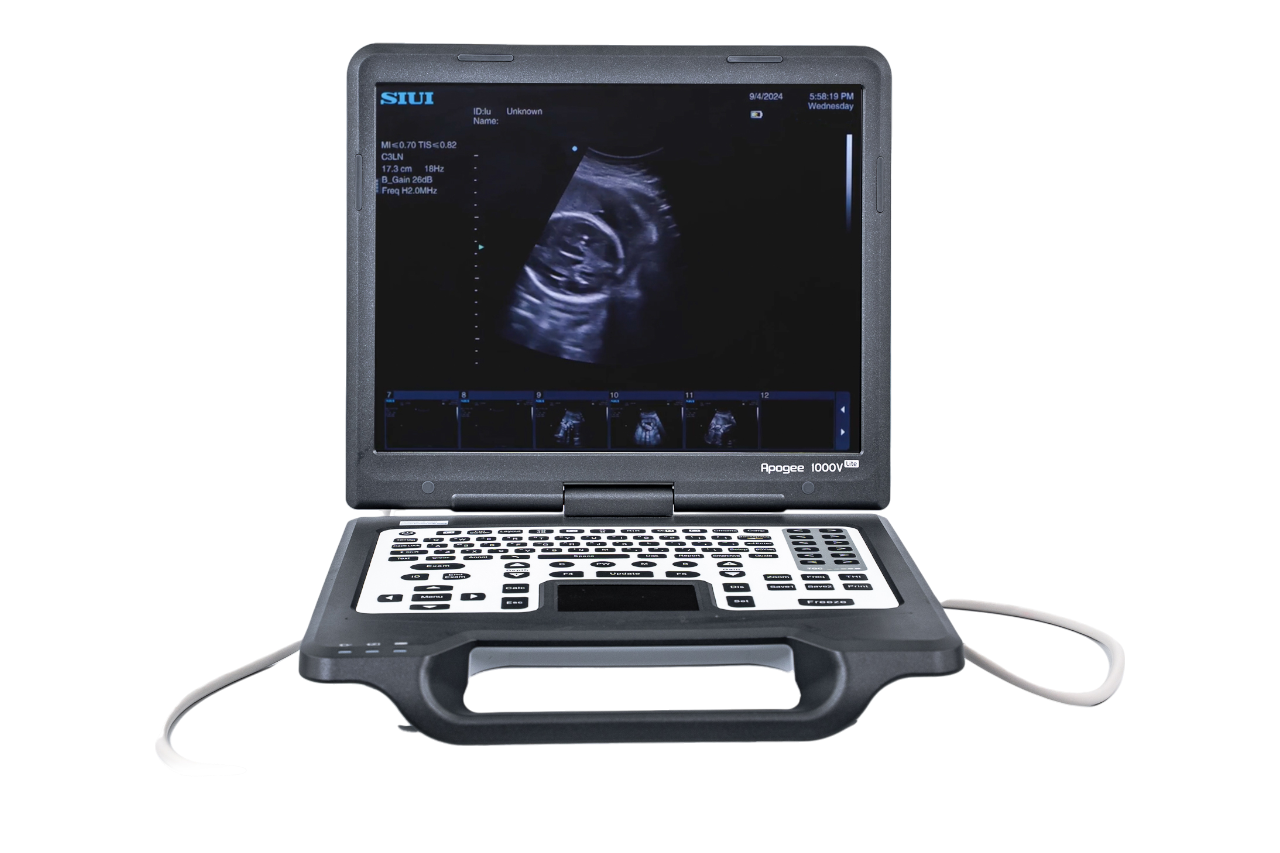 ECOGRAFO VETERINARIO PORTATIL SIUI Apogee 1000V Lite BW.1